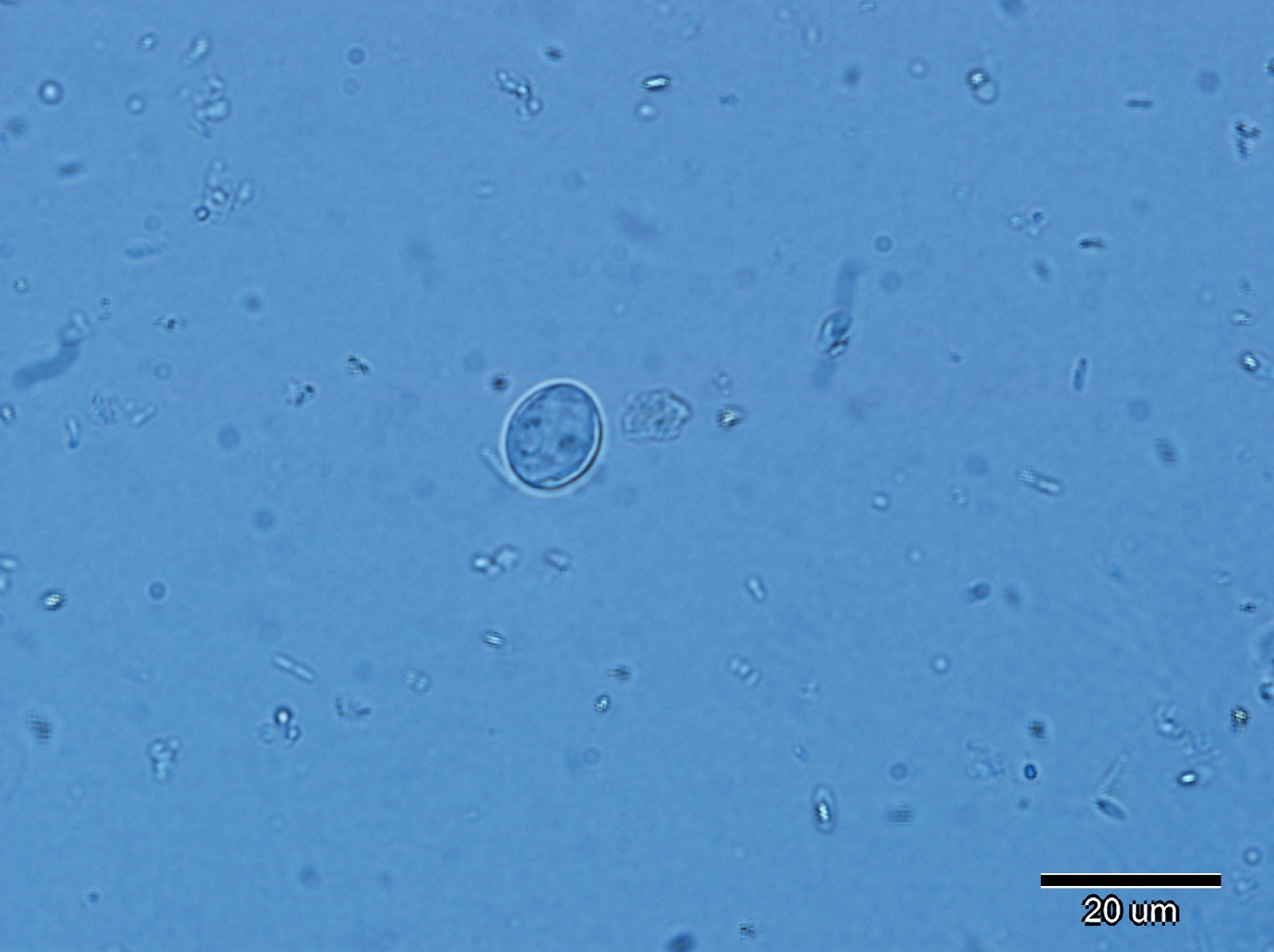 Zastosowanie preparatu Proflorin L w leczeniu wspomagającym giardiozy u psów 1 Cysta Giardia w rozmazie kału psa, mikroskop, skala 20 µm